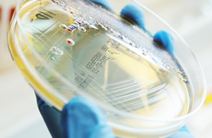 佛山沃特參加ACAS-PT2185 食品中霉菌和酵母計(jì)數(shù)（第一輪）能力驗(yàn)證 獲滿意結(jié)果